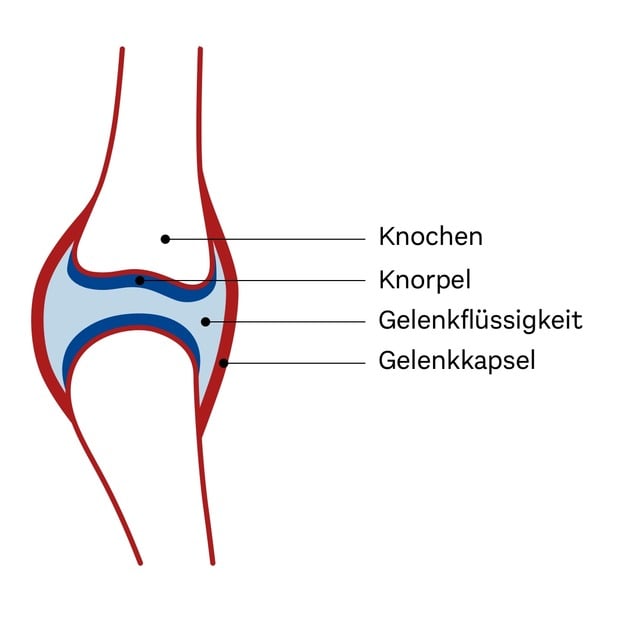 Gelenkaufbau